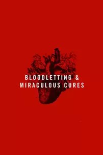 watch-Bloodletting & Miraculous Cures