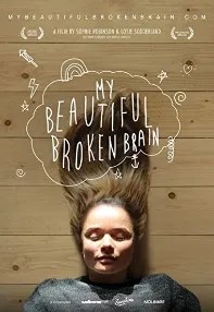 watch-My Beautiful Broken Brain