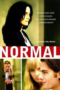 watch-Normal