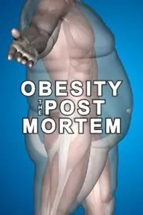 watch-Obesity: The Post Mortem