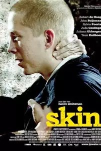 watch-Skin