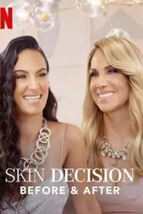 watch-Skin Decision: Before and After