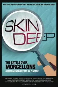 watch-Skin Deep: The Battle Over Morgellons