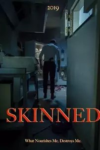 watch-Skinned