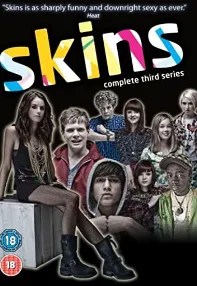 watch-Skins