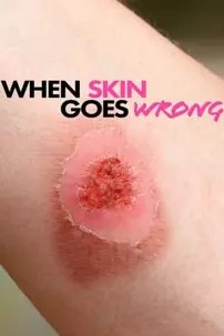 watch-When Skin Goes Wrong