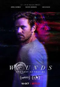 watch-Wounds